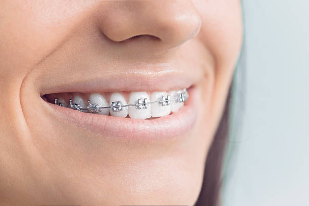 Best Full Mouth Reconstruction  in Fairview, CA